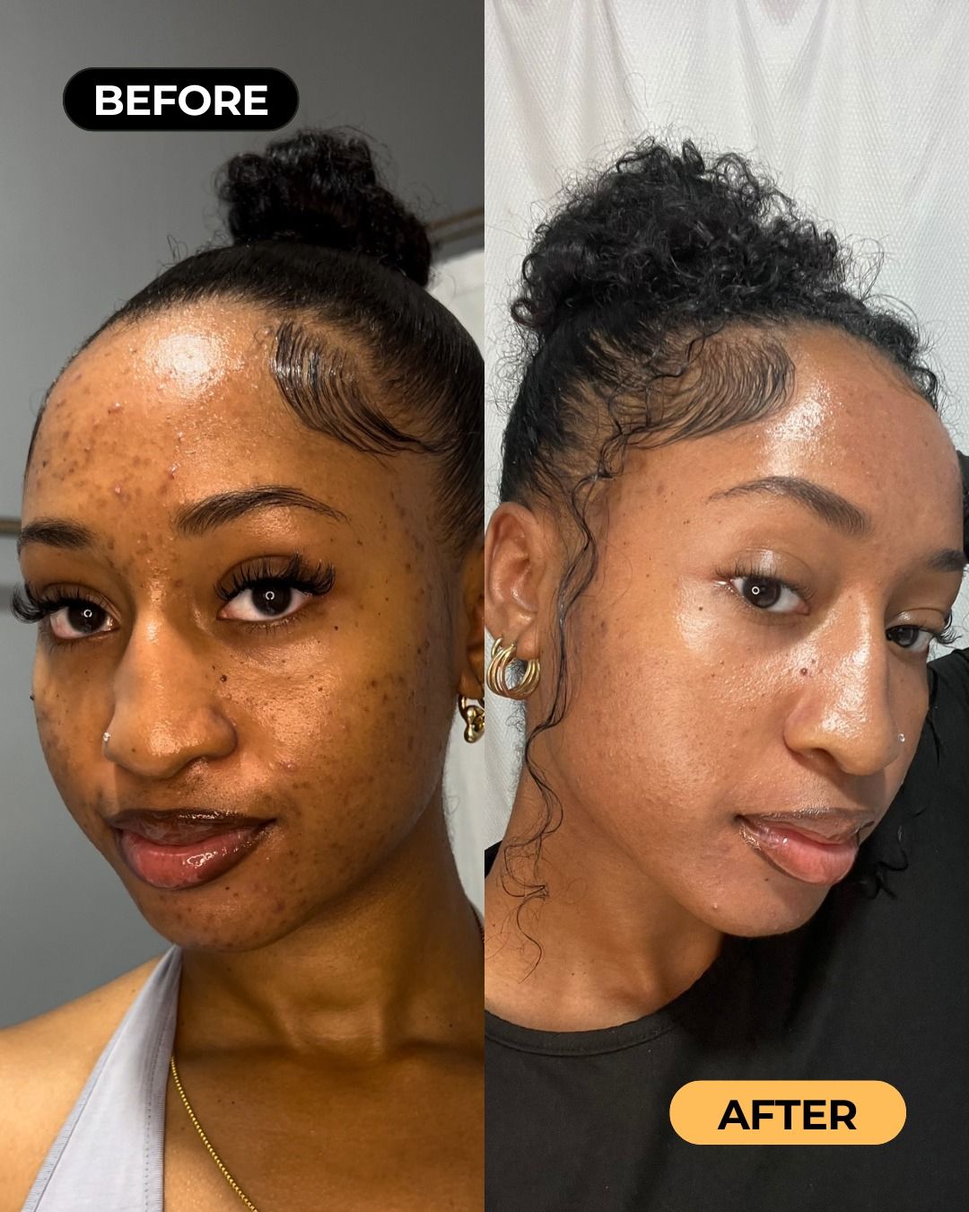 Fatimah K. before and after
