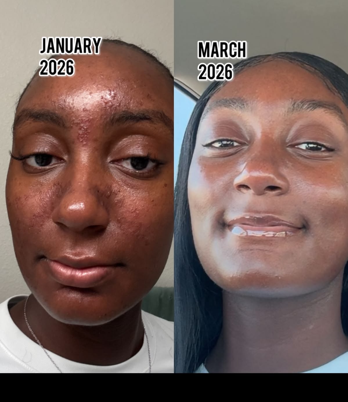 Ngozi E. before and after